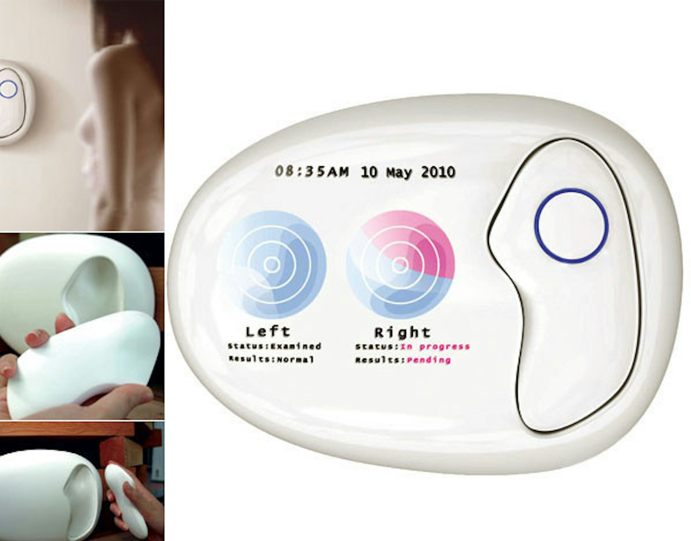 是[好奇] 女科科做乳癌檢查了嗎？這個乳房自我檢查機應該比男人手好用...這篇文章的首圖