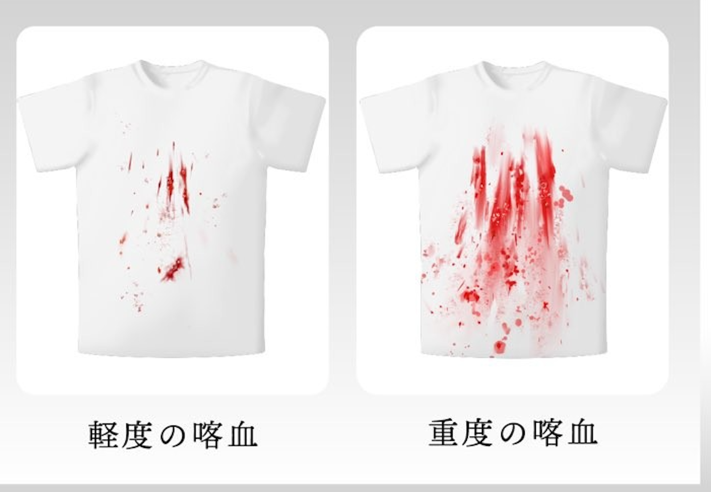 照片中提到了軽度の略血、重度の略血，包含了T卹、T恤衫、袖、襯衫、服裝