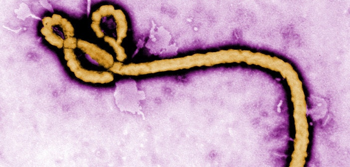 是伊波拉病毒恐懼蔓延 真偽資訊網路延燒這篇文章的首圖
